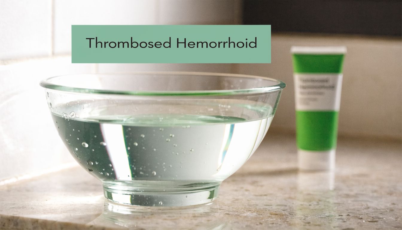 Understanding Symptoms of a Thrombosed Hemorrhoid