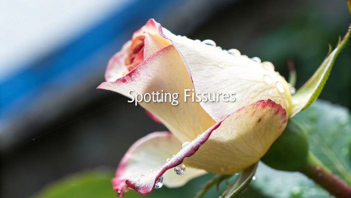 5 Ways to Spot an Anal Fissure and Finally Get Relief