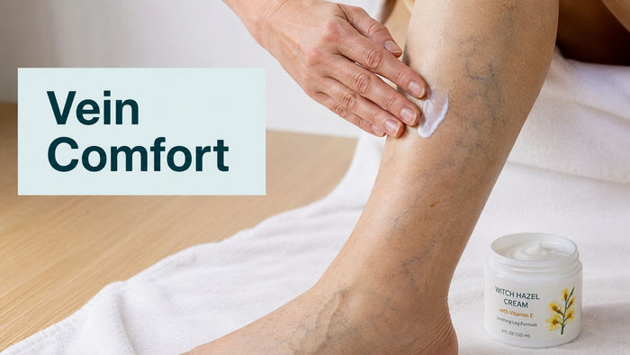 Witch Hazel Cream for Varicose Veins: What Works